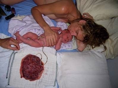placenta - Tras el parto comerse la placenta, ¿bueno o malo?