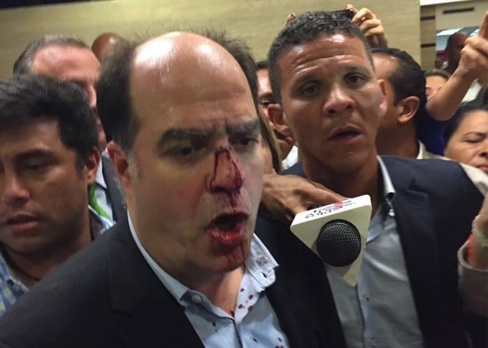 Así fue la golpiza a líder opositor de Venezuela