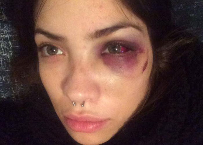 La periodista que denunció la brutal golpiza de su novio en Facebook