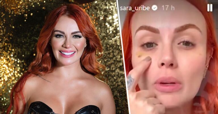 Sara Uribe - "Antes era linda" las críticas a Sara Uribe por mostrar su cara rellena de Botox